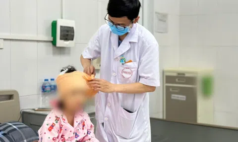Cảnh báo bệnh dại sắp 'vào mùa'
