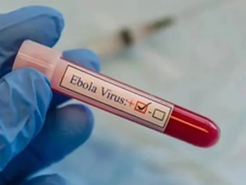 Tăng cường phòng chống Ebola, lưu ý trường hợp nhập cảnh từ nước có dịch trong 21 ngày